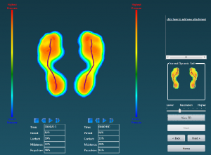 OrthoticsMapping